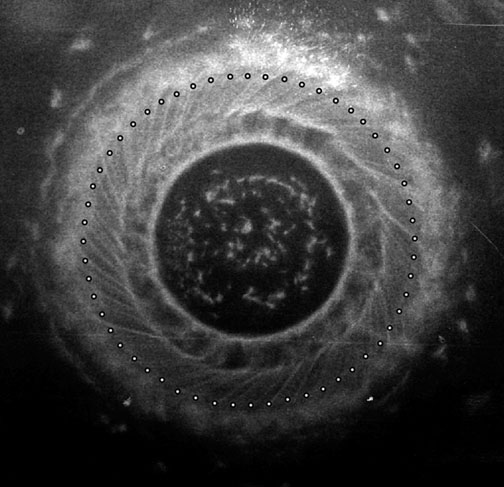 Penumbra of a dense plasma focus from a discharge current of 174,000 amperes. Penumbra of a dense plasma focus from a discharge current of 174,000 amperes.